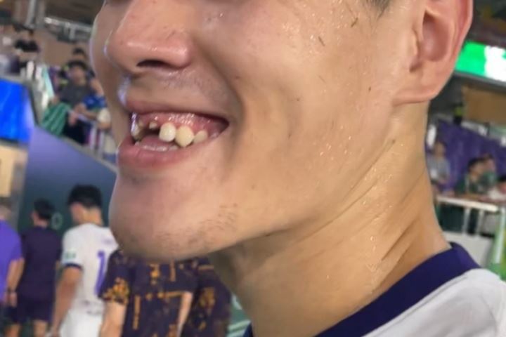 😨太惨了!津门虎0-2不敌浙江,中卫王献均门牙在比赛中被撞掉